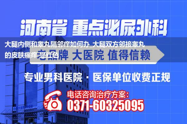 大腿内侧和睾丸隔邻痒如何办_大腿双方邻接睾丸的皮肤瘙痒 显红色